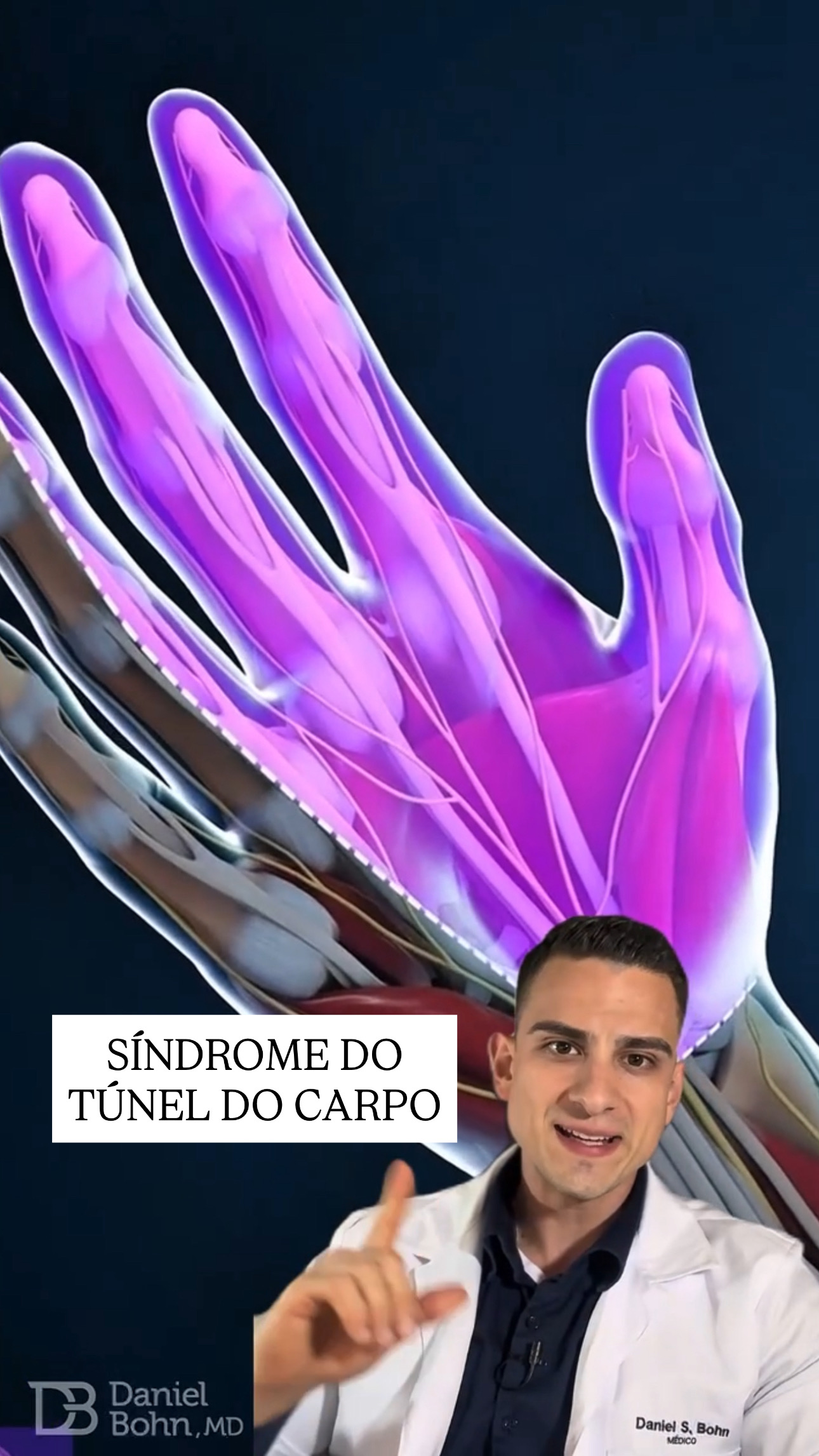 Síndrome do Túnel do Carpo Daniel Bohn Anatomia