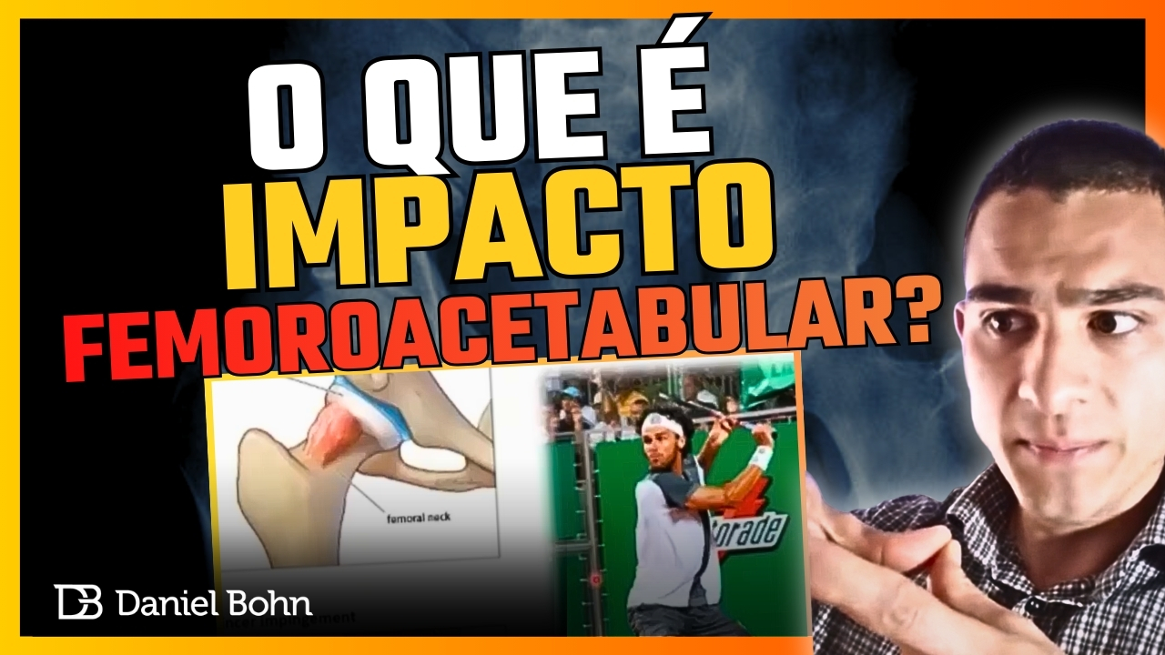impacto femoroacetabular Daniel Bohn